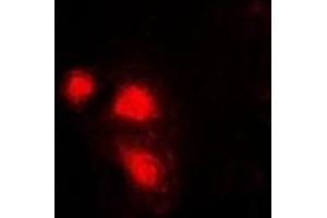 Immunofluorescent analysis of eIF3E staining in Hela cells. (EIF3E antibody)