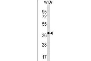 CLCA3P Antibody (Center) (ABIN1538576 and ABIN2850211) western blot analysis in WiDr cell line lysates (35 μg/lane). (CLCA3P antibody  (AA 70-98))