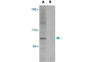 Western blot analysis of NLRP3 in K-562 cell lysate with NLRP3 polyclonal antibody  at 1 ug/mL (A) in the absence and (B) in the presence of blocking peptide. (NLRP3 antibody  (AA 120-170))
