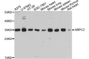 Western blot analysis of extracts of various cell lines, using ARPC2 antibody. (ARPC2 antibody)
