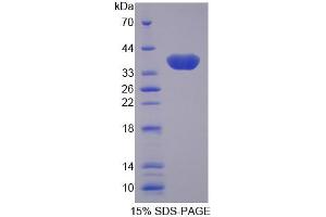 SDS-PAGE (SDS) image for Galectin 4 (LGALS4) (AA 1-323) protein (His tag) (ABIN6236628) (GAL4 Protein (AA 1-323) (His tag))