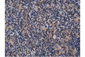 Immunohistochemistry (IHC) image for anti-rho GTPase Activating Protein 25 (ARHGAP25) antibody (ABIN1496707) (ARHGAP25 antibody)