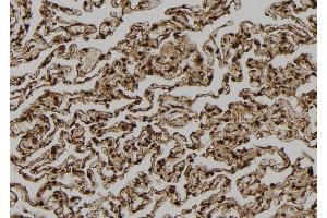 ABIN6272867 at 1/100 staining Human lung tissue by IHC-P. (TPI1 antibody  (C-Term))