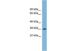WB Suggested Anti-MPZL2 Antibody Titration:  0. (MPZL2 antibody  (N-Term))