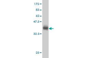 Western Blot detection against Immunogen (35. (ACADVL antibody  (AA 345-434))