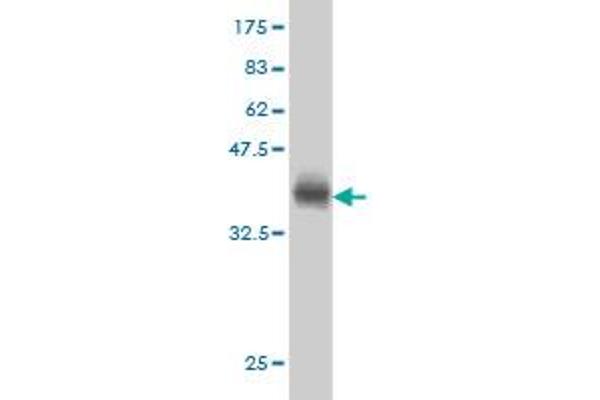 ACADVL antibody  (AA 345-434)