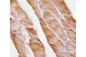 Immunohistochemical analysis of paraffin-embedded mouse skeletal muscle using Musk antibody at 1:25 dilution.