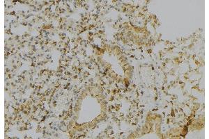 ABIN6277149 at 1/100 staining Human gastric tissue by IHC-P. (HLA-A antibody)
