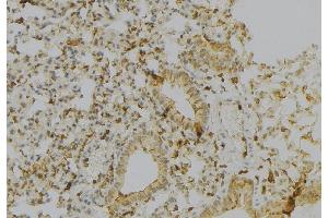 ABIN6277149 at 1/100 staining Human gastric tissue by IHC-P.