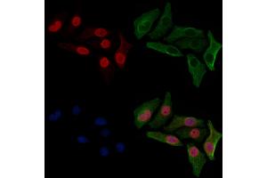 ABIN6254899 and ABIN6267063 staining HepG2 cells(30 min of 4uM Forskolin treatment) by IF/ICC. (Histone H4 antibody  (H4K12ac))