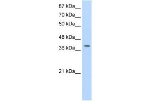 WB Suggested Anti-LAntibody Titration:  1. (LARP7 antibody  (C-Term))