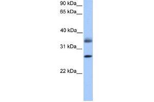 WB Suggested Anti-LGALS8 Antibody Titration: 0. (LGALS8 antibody  (C-Term))