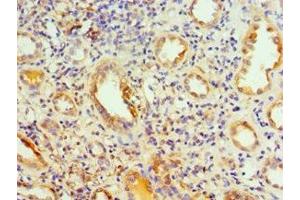 Immunohistochemistry of paraffin-embedded human kidney tissue using ABIN7142036 at dilution of 1:100 (PIKFYVE antibody  (AA 1819-2098))