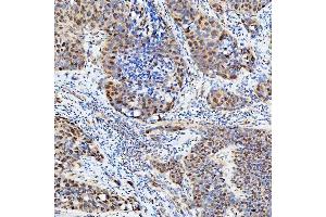 IHC analysis of U1-C/SNRPC using anti-U1-C/SNRPC antibody (ABIN7599016). (SNRPC antibody  (AA 1-159))