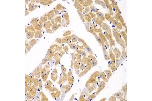 Immunohistochemistry of paraffin-embedded mouse heart using TOMM20 antibody (ABIN5974102) at dilution of 1/100 (40x lens). (TOMM20 antibody)