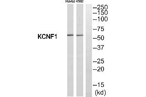 Western blot analysis of extracts from HuvEc cells and K562 cells, using KCNF1 antibody. (KCNF1 antibody  (Internal Region))