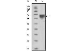 Western blot analysis using TYRO3 mouse mAb against extracellular domain of human TYRO3 (aa41-429). (TYRO3 antibody)