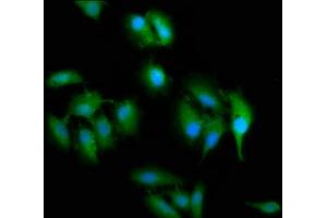 Immunofluorescence staining of Hela cells with ABIN7169791 at 1:200, counter-stained with DAPI. (SLC2A4RG antibody  (AA 1-100))