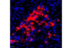 Immunofluorescence of paraffin embedded human pancreas using RBP (ABIN7075409) at dilution of 1: 650 (400x lens)