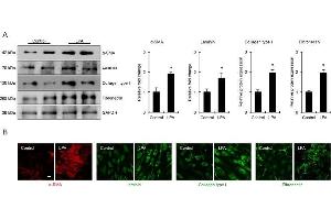 Western Blotting (WB) image for anti-COL1A2/COL1A1 antibody (ABIN5596819)