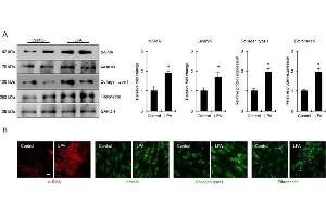 Western Blotting (WB) image for anti-Collagen, Type I (COL1) antibody (ABIN5596819)