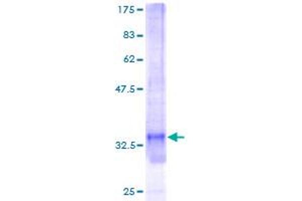 SNRPG Protein (AA 1-76) (GST tag)