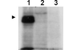Image no. 1 for anti-MLF1 Interacting Protein (MLF1IP) (Thr78) antibody (ABIN401336) (MLF1IP antibody  (Thr78))