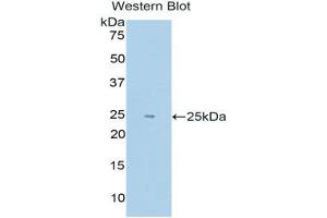 Western Blotting (WB) image for anti-Endothelial PAS Domain Protein 1 (EPAS1) (AA 339-541) antibody (ABIN1176134) (EPAS1 antibody  (AA 339-541))