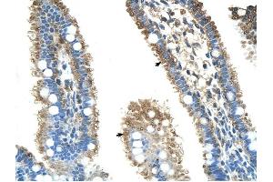 ALDH4A1 antibody was used for immunohistochemistry at a concentration of 4-8 ug/ml to stain Epithelial cells of intestinal villus (arrows) in Human Intestine.