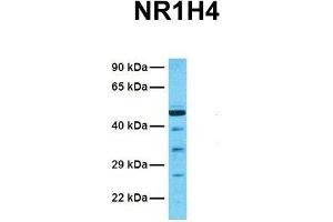 Western Blotting (WB) image for anti-Nuclear Receptor Subfamily 1, Group H, Member 4 (NR1H4) (Middle Region) antibody (ABIN2778066)