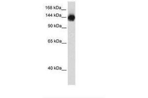 Image no. 1 for anti-Timeless Homolog (TIMELESS) (N-Term) antibody (ABIN202979) (TIMELESS antibody  (N-Term))