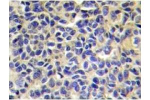 Image no. 1 for anti-Endoplasmic Reticulum Aminopeptidase 1 (ERAP1) antibody (ABIN272255) (ERAP1 antibody)
