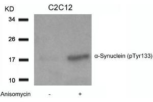 Western blot analysis of extracts from C2C12 cells untreated or treated with Anisomycin using a-Synuclein(Phospho-Tyr133) Antibody. (SNCA antibody  (pTyr133))