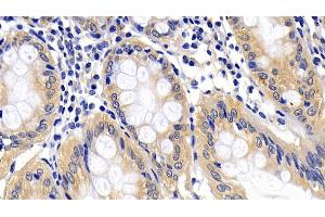 Immunohistochemistry (IHC) image for anti-Apoptotic Peptidase Activating Factor 1 (APAF1) (AA 31-350) antibody (ABIN7433081)