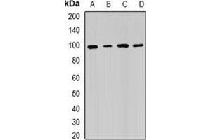 Western blot analysis of RRM1 expression in Hela (A), SW480 (B), mouse testis (C), mouse spleen (D) whole cell lysates. (RRM1 antibody)
