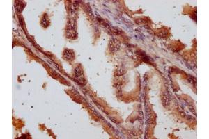 IHC image of ABIN7144227 diluted at 1:500 and staining in paraffin-embedded human prostate tissue performed on a Leica BondTM system.
