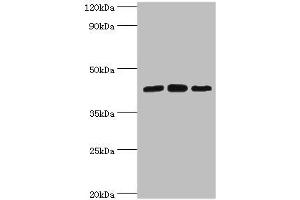 Western blot All lanes: Nucleolysin TIA-1 isoform p40 antibody at 2 μg/mL Lane 1: Jurkat whole cell lysate Lane 2: K562 whole cell lysate Lane 3: Hela whole cell lysate Secondary Goat polyclonal to rabbit IgG at 1/10000 dilution Predicted band size: 43, 42, 25 kDa Observed band size: 43 kDa (TIA1 antibody  (AA 1-193))