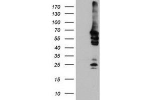 HEK293T cells were transfected with the pCMV6-ENTRY control (Left lane) or pCMV6-ENTRY NMT2 (Right lane) cDNA for 48 hrs and lysed. (NMT2 antibody)