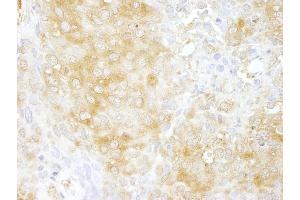 anti-rho GTPase Activating Protein 1 (ARHGAP1) (AA 1-50) antibody