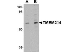 Western blot analysis of TMEM214 in A20 cell lysate with this product at (A) 1 and (B) 2 μg/ml. (TMEM214 antibody  (N-Term))