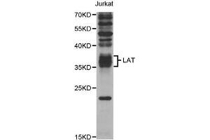 Western Blotting (WB) image for anti-Linker For Activation of T Cells (LAT) antibody (ABIN1876851) (LAT antibody)