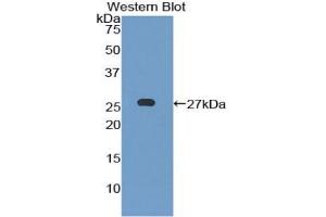 Detection of Recombinant LILRB3, Mouse using Polyclonal Antibody to Leukocyte Immunoglobulin Like Receptor Subfamily B, Member 3 (LILRB3) (LILRB3 antibody  (AA 410-631))