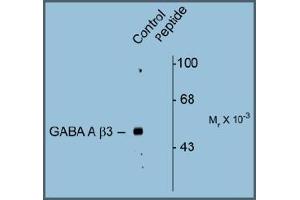 Western blot of Rat hippocampal lysate showing specific immunolabeling of the ~53k GABAAB3 protein phosphorylated at Serine408/409 (Control). (GABRB3 antibody  (pSer408, pSer409))