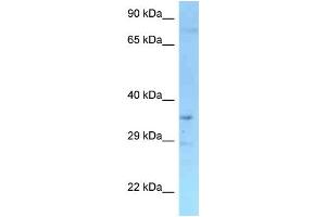 WB Suggested Anti-Rffl Antibody Titration: 1.