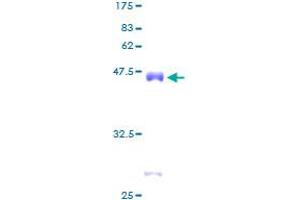 CSRP2 Protein (AA 1-193) (GST tag)