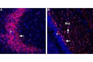 Expression of GluR7 in mouse hippocampus and rat cerebellum - Immunohistochemical staining of immersion-fixed, free floating frozen brain sections using Anti-GRIK3 (GluK3) (extracellular) Antibody (ABIN7043239, ABIN7044378 and ABIN7044379), (1:400). (GRIK3 antibody  (Extracellular, N-Term))