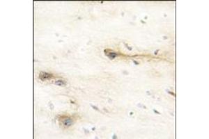Formalin-fixed and paraffin-embedded human brain tissue reacted with MARK1 Antibody (N-term), which was peroxidase-conjugated to the secondary antibody, followed by DAB staining. (MARK1 antibody  (N-Term))