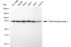 Western blotting analysis using TANK binding kinase 1 antibody (ABIN7800507).