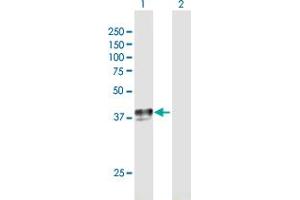 Western Blot analysis of SLC29A1 expression in transfected 293T cell line by SLC29A1 MaxPab polyclonal antibody. (SLC29A1 antibody  (AA 1-456))