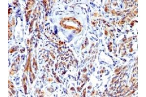 IHC testing of FFPE human uterus with recombinant Caldesmon antibody. (Caldesmon HMW antibody)